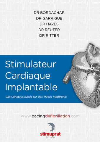 Stimulateur Cardiaque Implantable