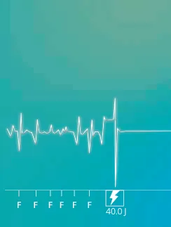 New recommendations and non-sustained tachycardia