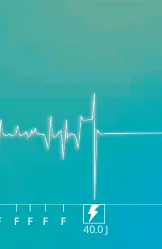 New recommendations and non-sustained tachycardia