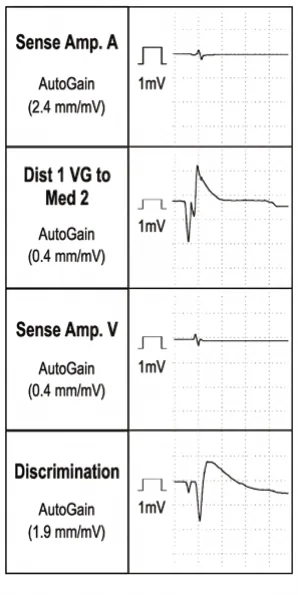 Operating principles, specific features of the Gallant platform