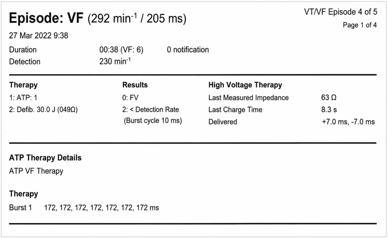 Classification of cycles and ventricular undersensing during an episode of VF