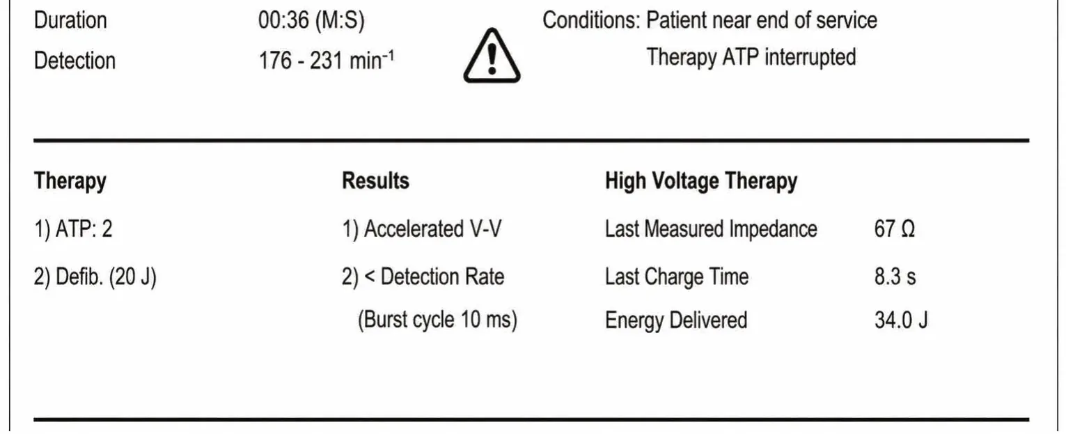 Redetection counter after acceleration of VT in the VF zone