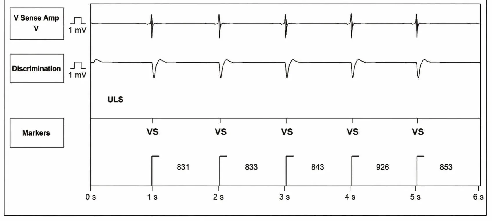 New recommandations and number cycles in initial detection