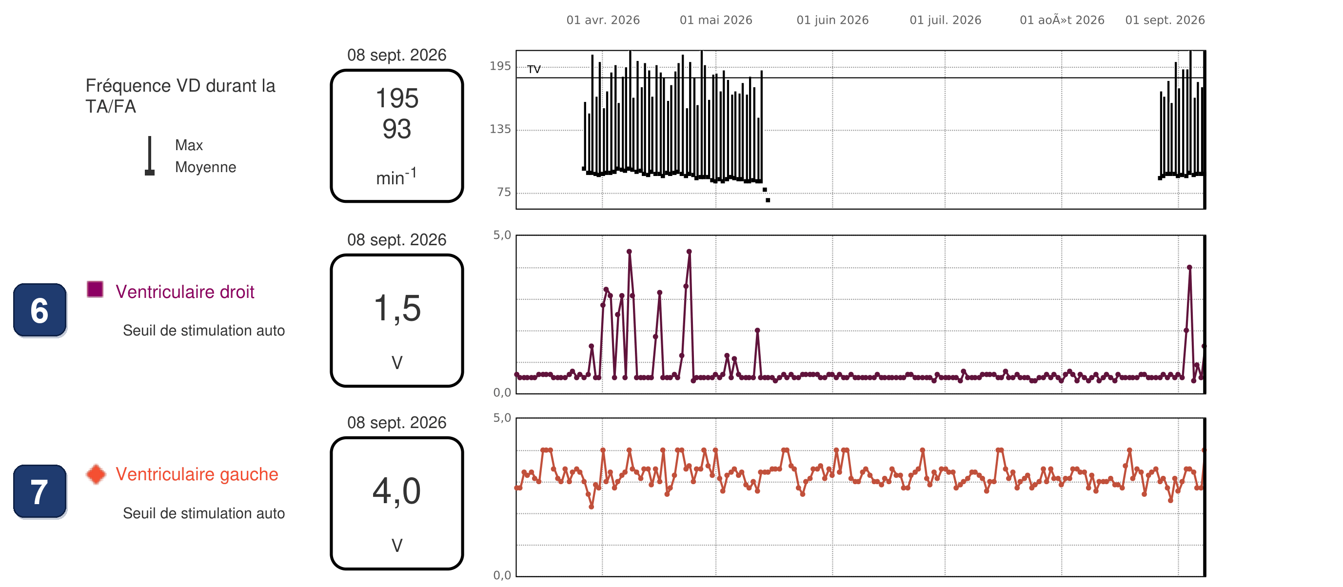 Boston Scientific CRT electrogram, segment 4/5 — BiV Trigger in AF, and the same patient 15 months later
