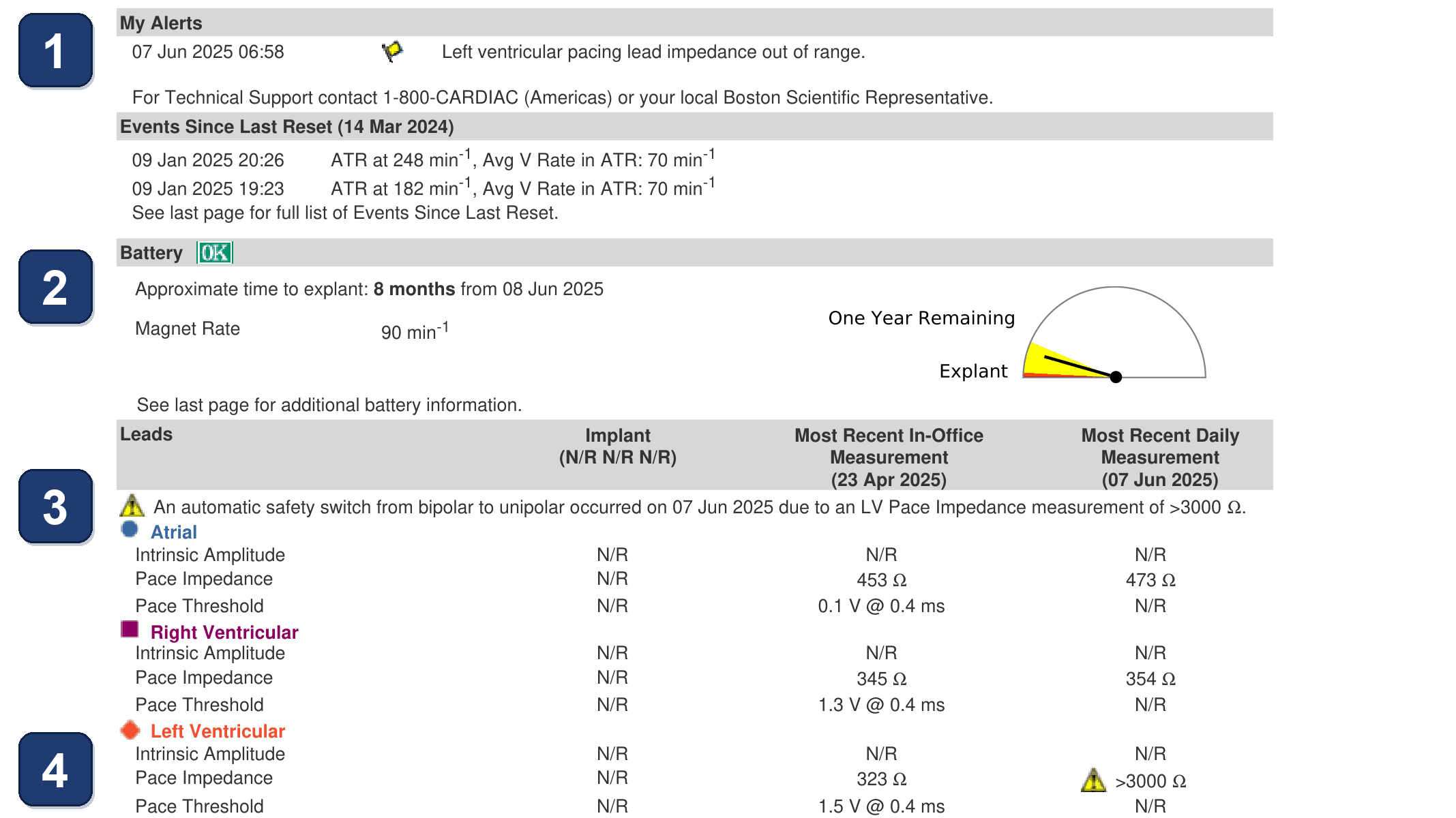 Boston Scientific CRT electrogram, segment 1/7 — LV impedance out-of-range alert near battery end of life