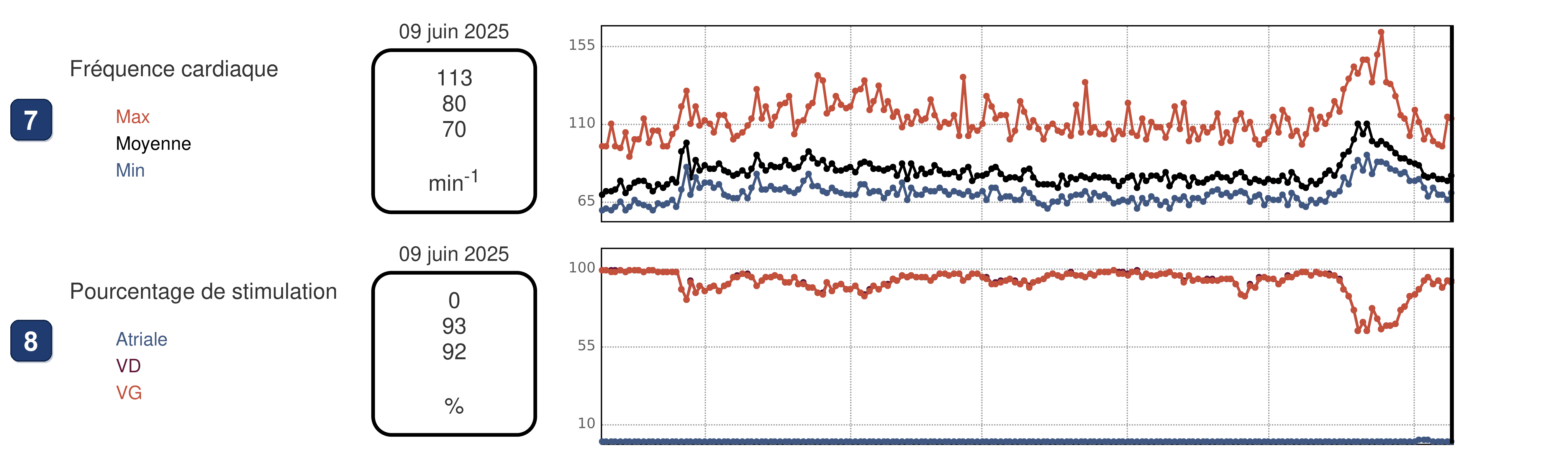 Boston Scientific CRT electrogram, segment 3/3 — BiV markers with changing far-field morphology