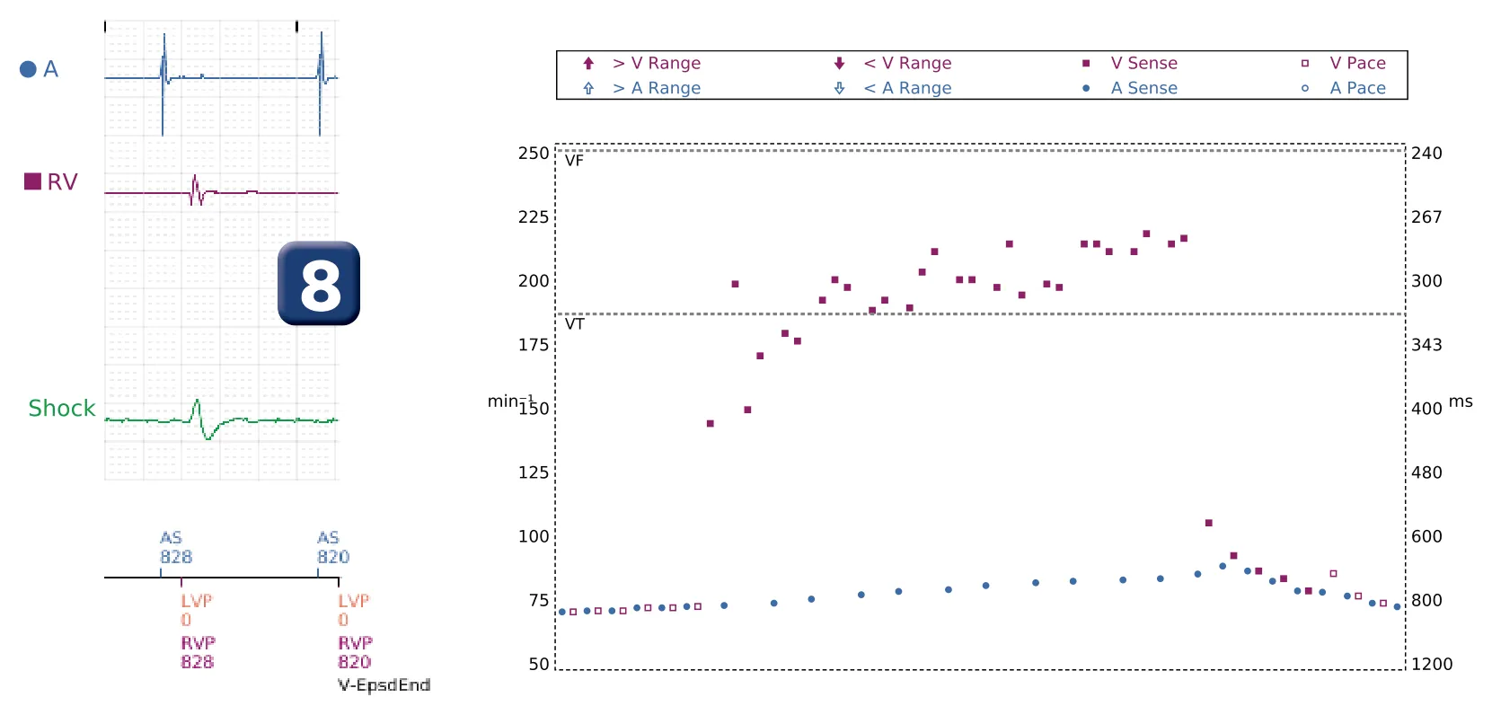 Last cycles and interval plot — Non-sustained ventricular tachycardia