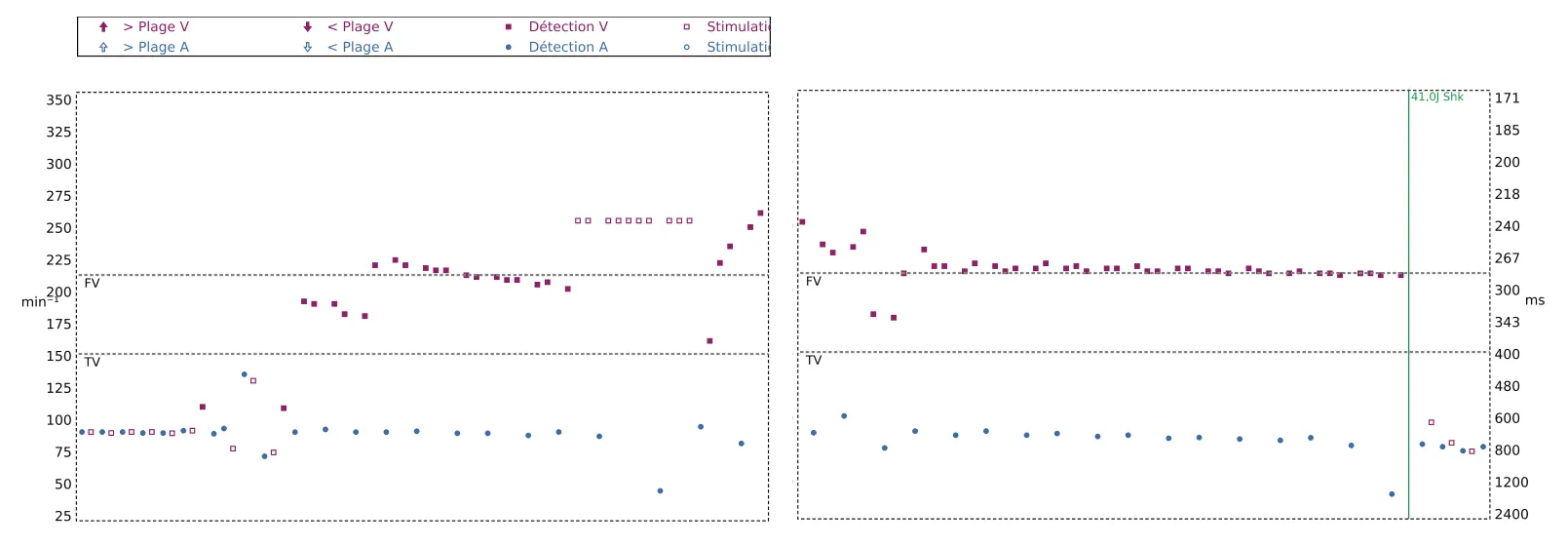 Interval plot — Change of detection zone
