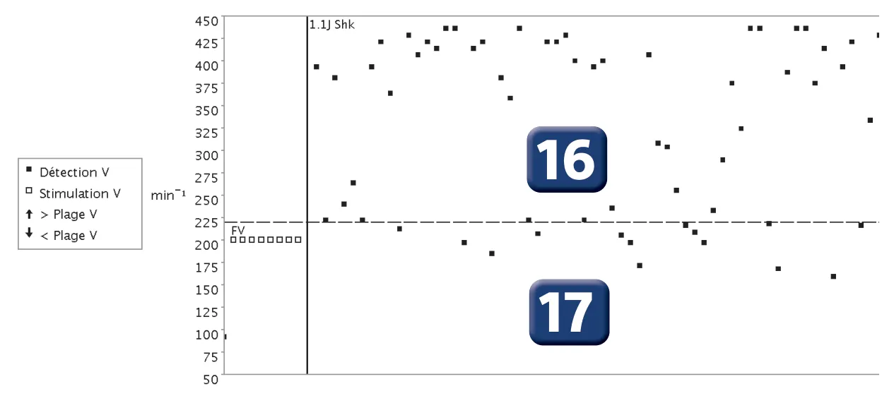 Figure — Undersensing and charge diversion