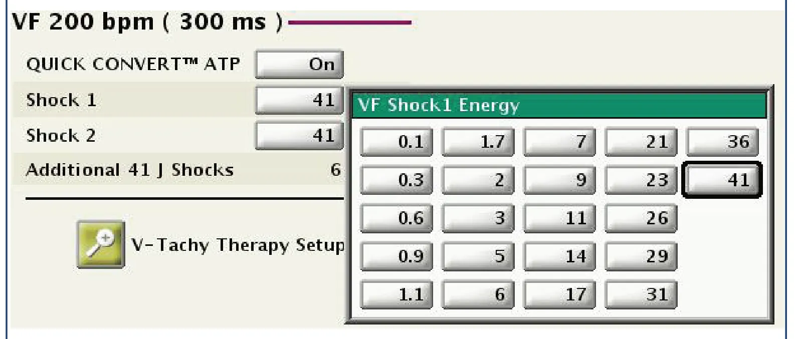 This figure shows the various programming options for the amplitude of the first shock in the VF zone; the amplitude of the second shock is also programmable but must be at least equal to that of the first; the amplitude of shocks 3-8 is necessarily maximum (41 joules; in the VF zone, 8 shocks can be delivered).