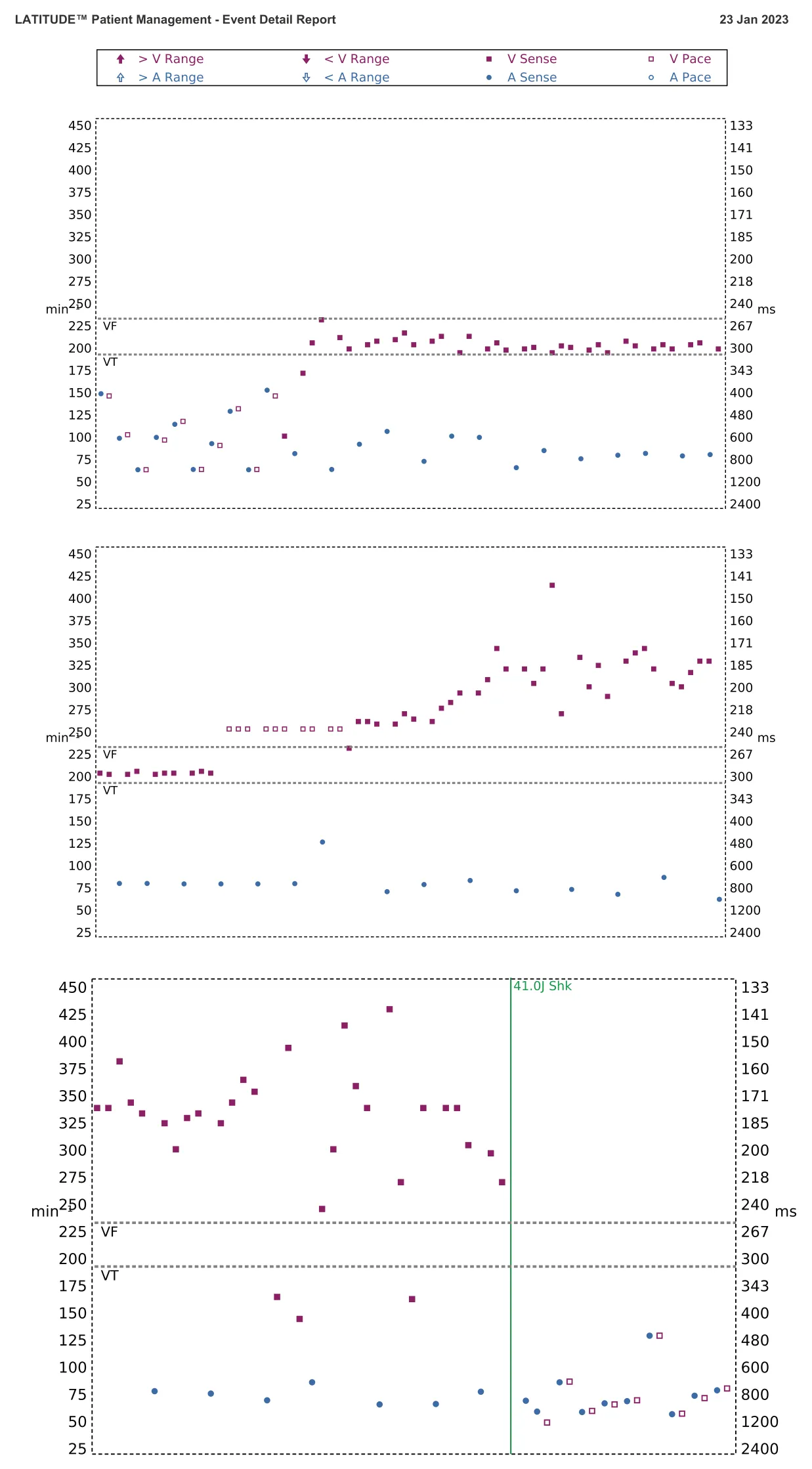 Interval plot — Anti-tachycardia pacing in the VT zone with acceleration into the VF zone