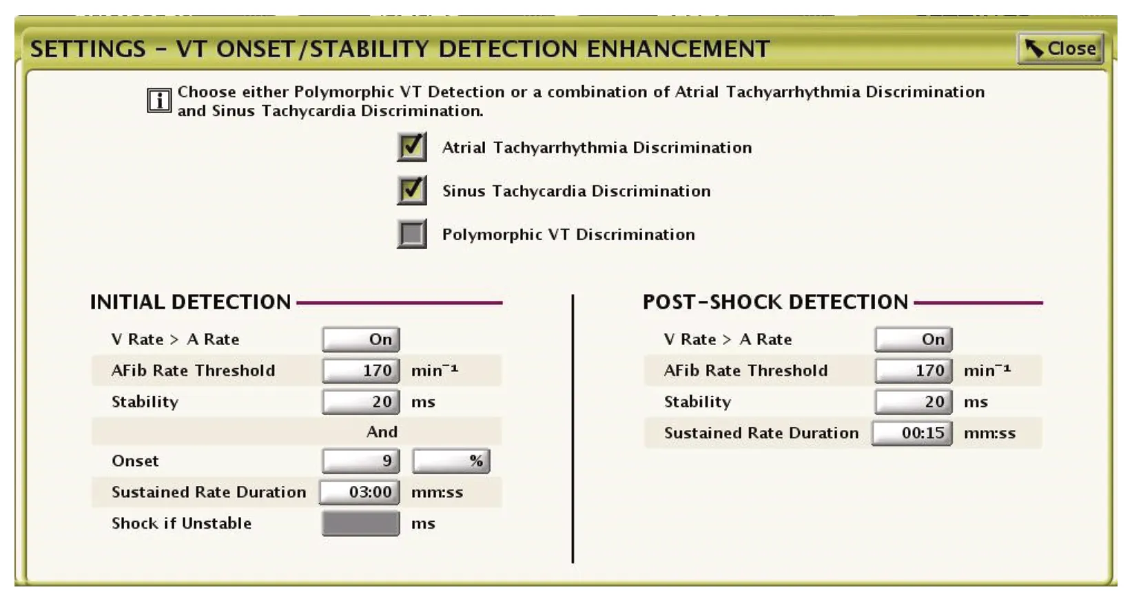 Onset/Stability detection settings