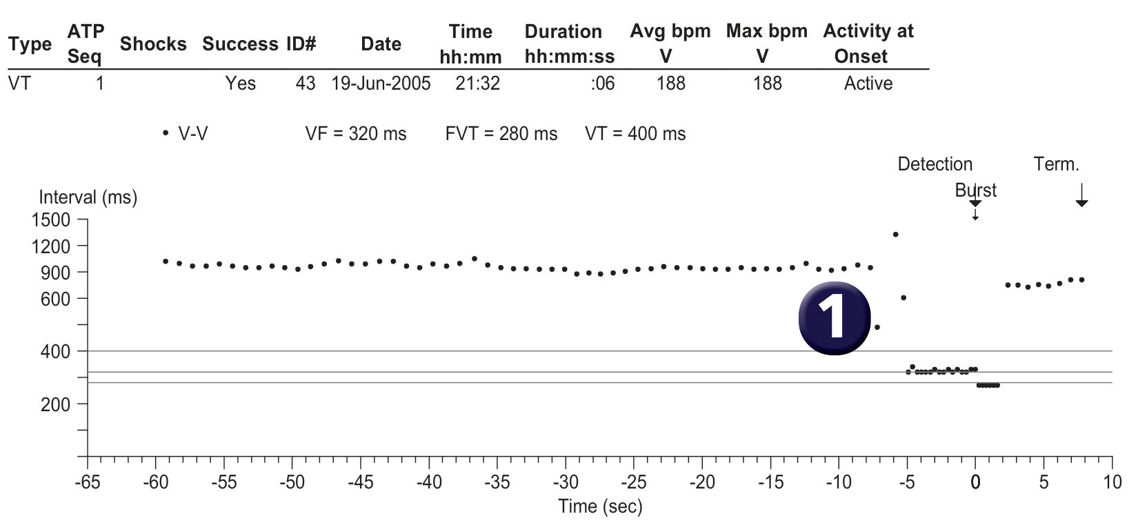 Medtronic ICD electrogram, segment 1 of 1 — Specifics of the VT counter