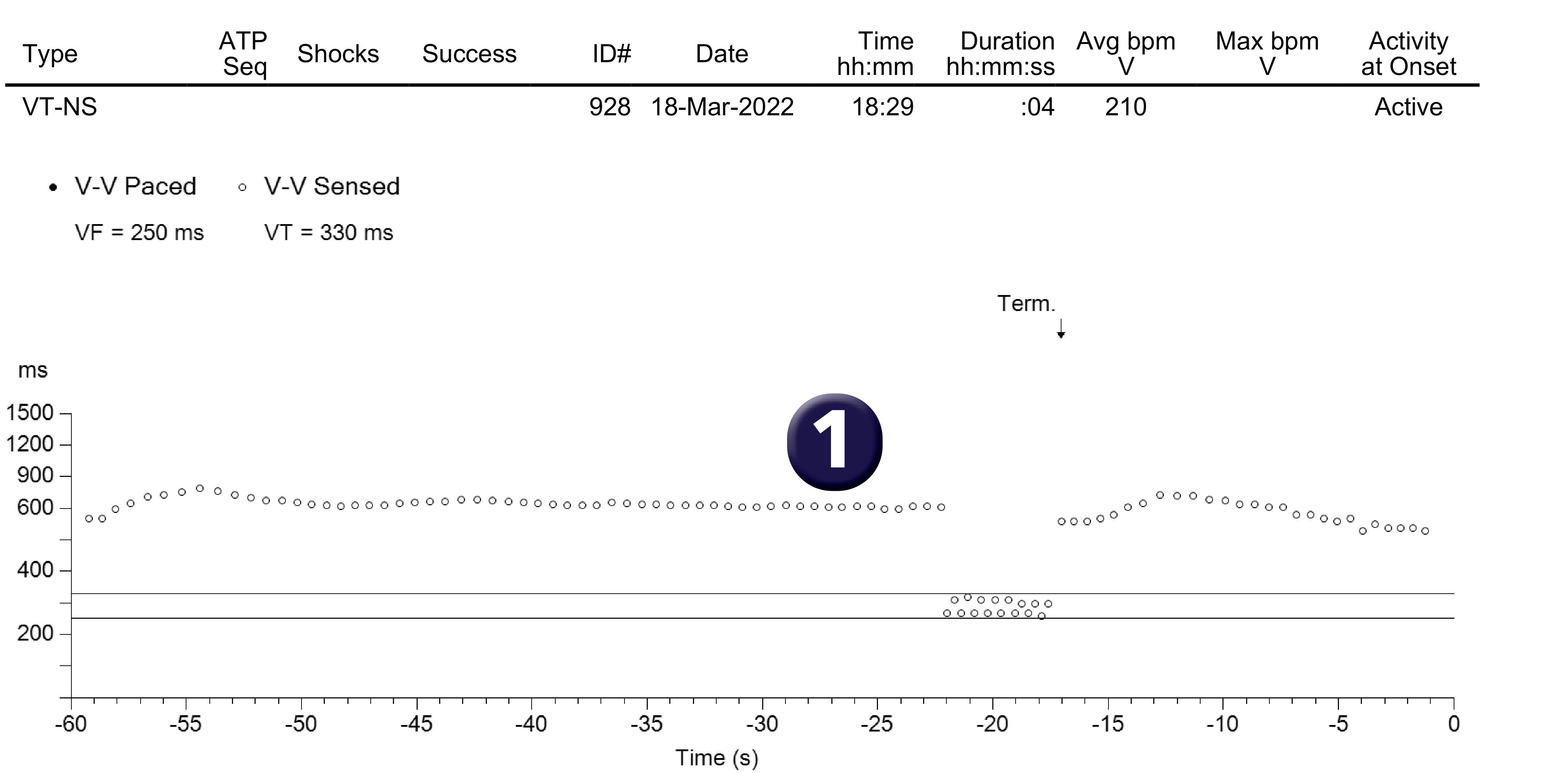 Medtronic ICD electrogram, segment 1 of 1 — A special kind of plot