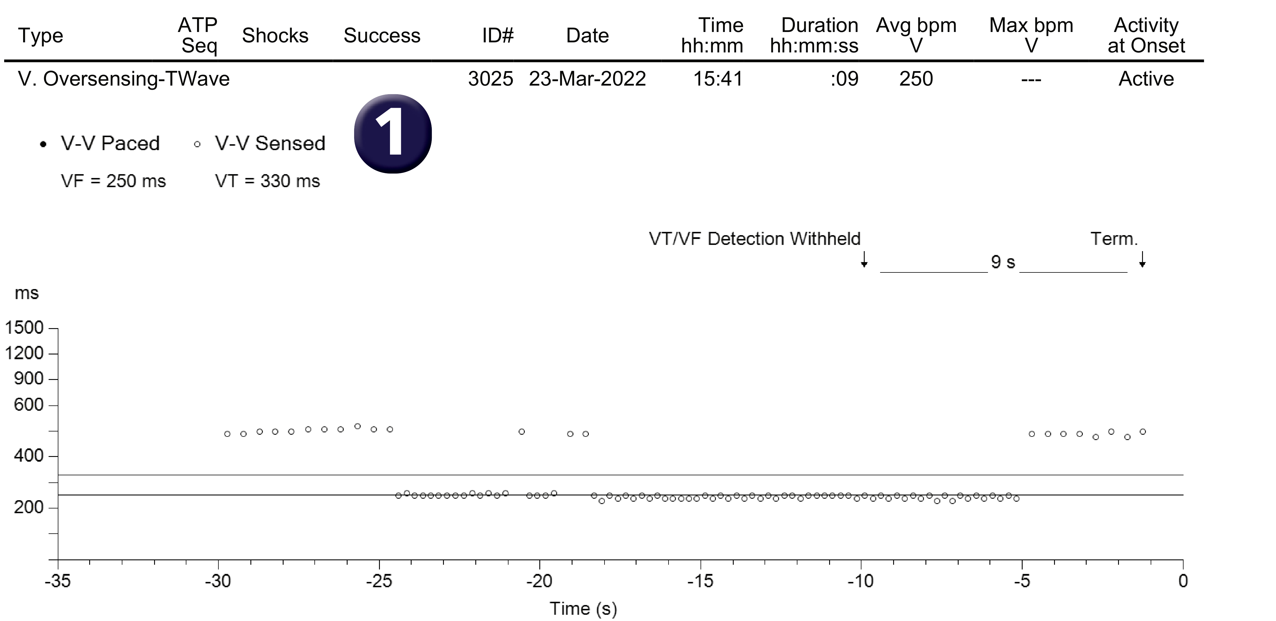 Medtronic ICD electrogram, segment 1 of 1 — Use of a specific algorithm