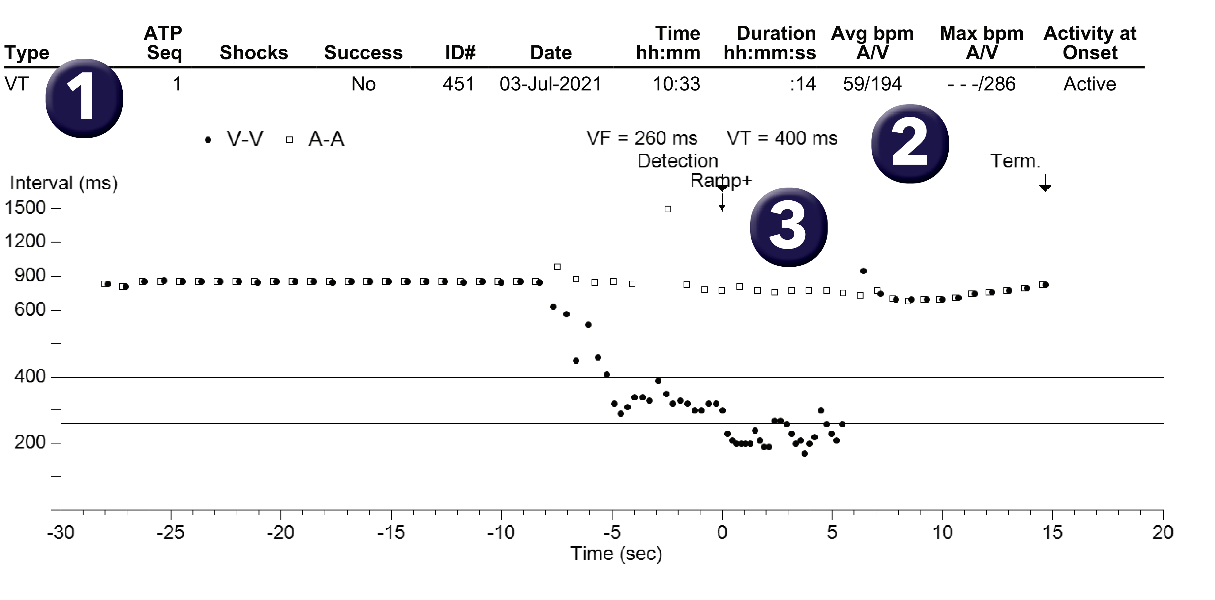 Medtronic ICD electrogram, segment 1 of 1 — PR Logic versus Wavelet