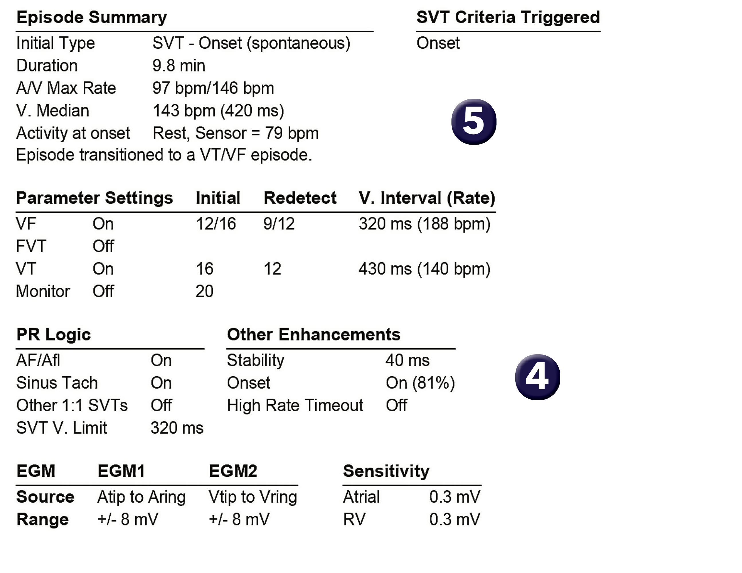 Medtronic ICD electrogram, segment 1 of 1 — Using single-chamber discriminators in a dual-chamber defibrillator