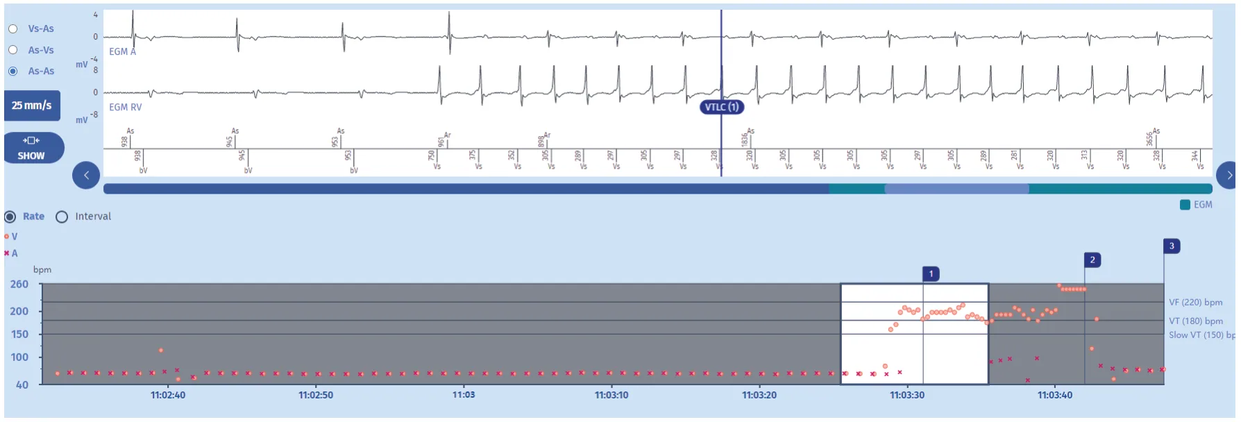 MicroPort ICD, Episode (first screen) — Counting in the VT zone