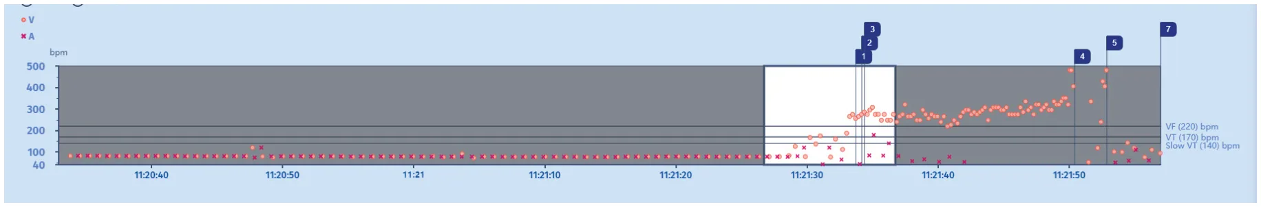 MicroPort ICD, Interpretation — Competing counters