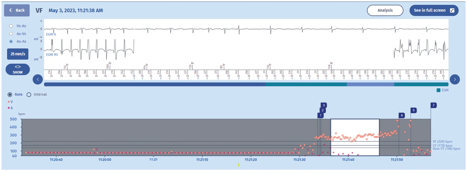 MicroPort ICD, EGM — Competing counters