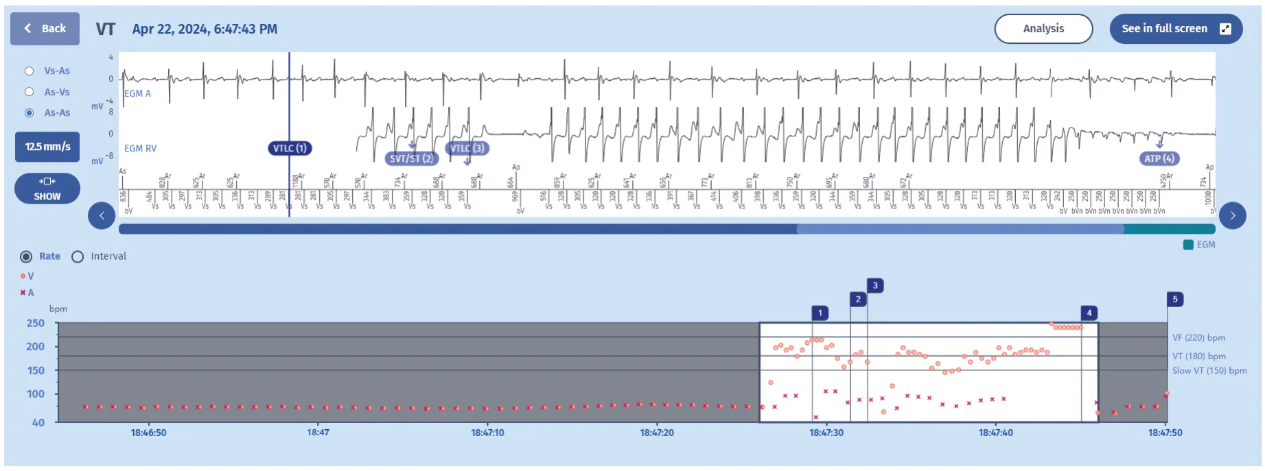 MicroPort ICD, Interpretation — Persistence
