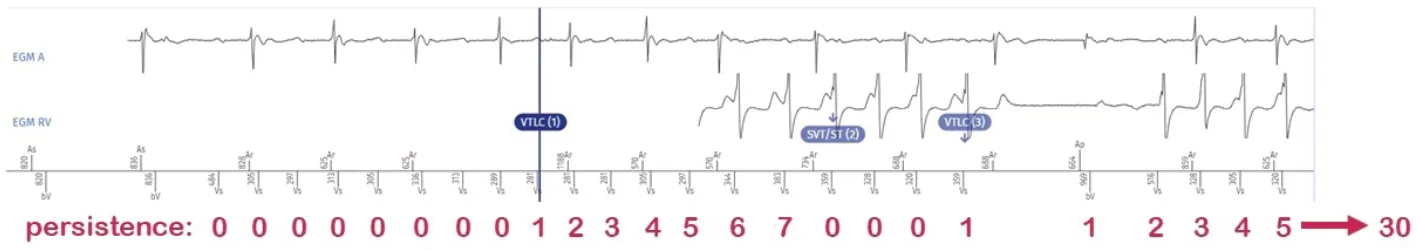 MicroPort ICD, Comments — Persistence