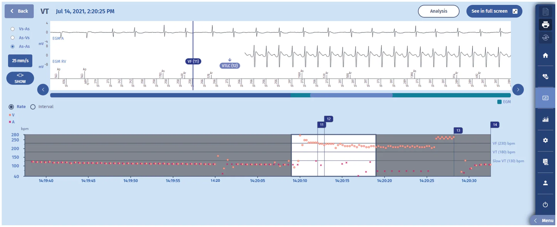 MicroPort ICD, The newest episode with therapy is the following: — Long VT