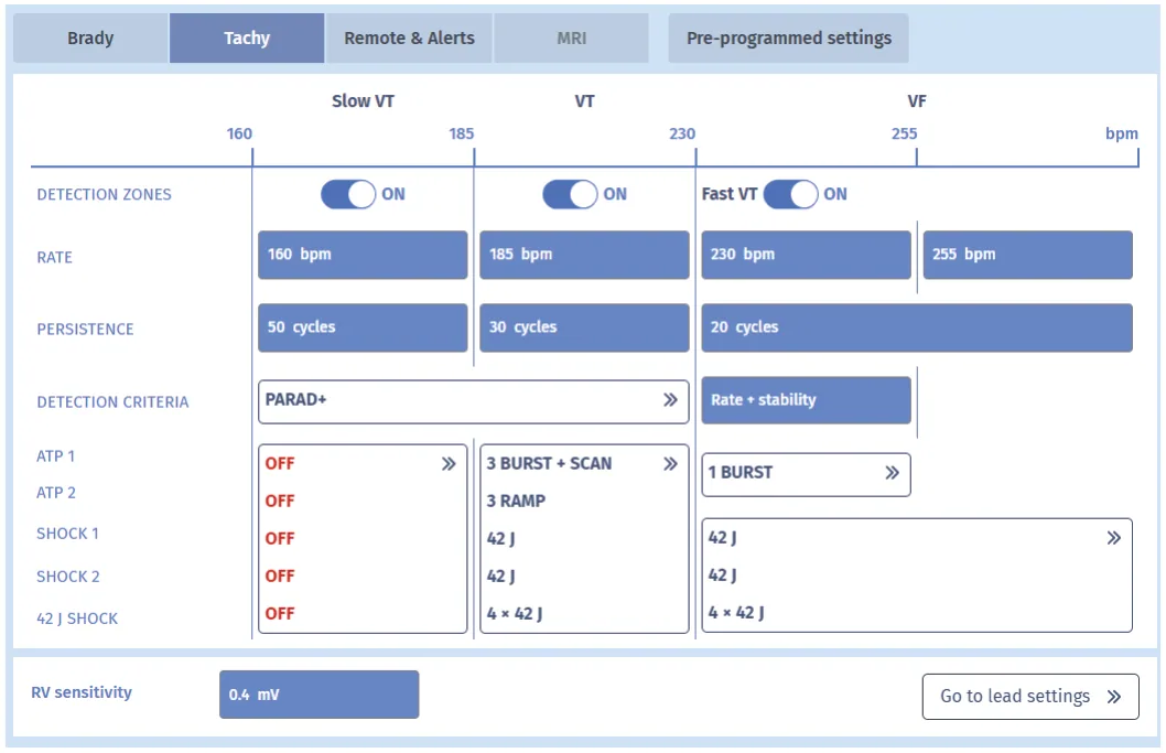 MicroPort ICD, Here is the overview screen, notice that there has been one episode with therapies — Tachycardia treated with a shock