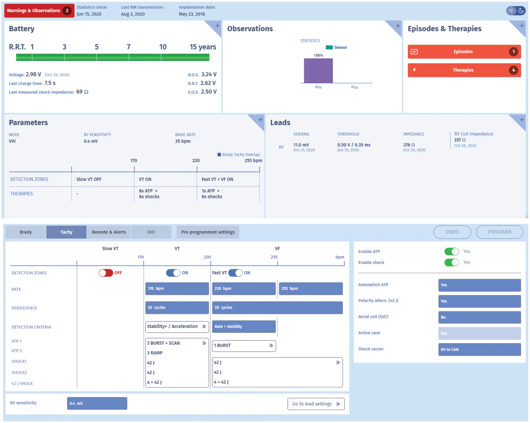 MicroPort ICD, Programming — What about morphology?