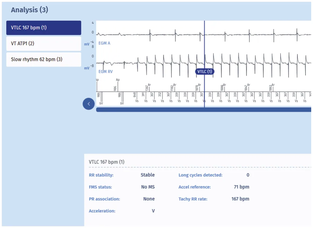 MicroPort ICD, Comments — Preferred PARAD+ pathway