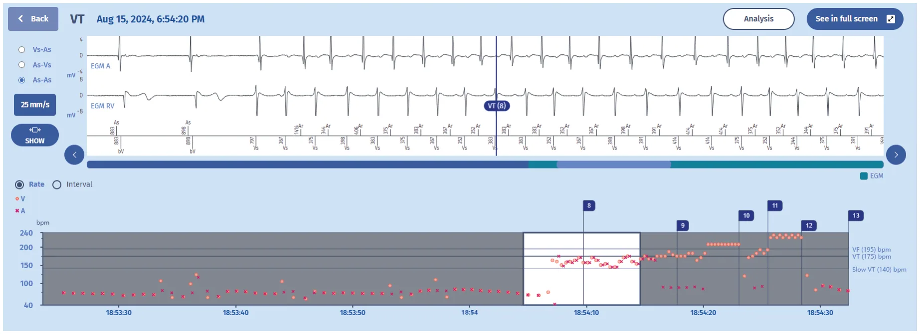 MicroPort ICD, This is the newest episode — 1:1 tachycardia