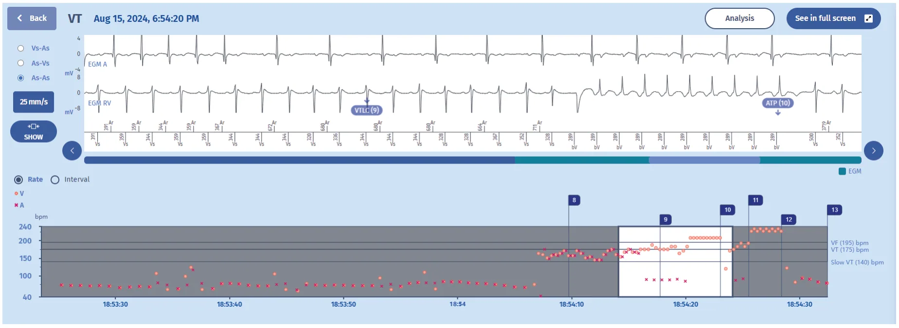 MicroPort ICD, Comments — 1:1 tachycardia