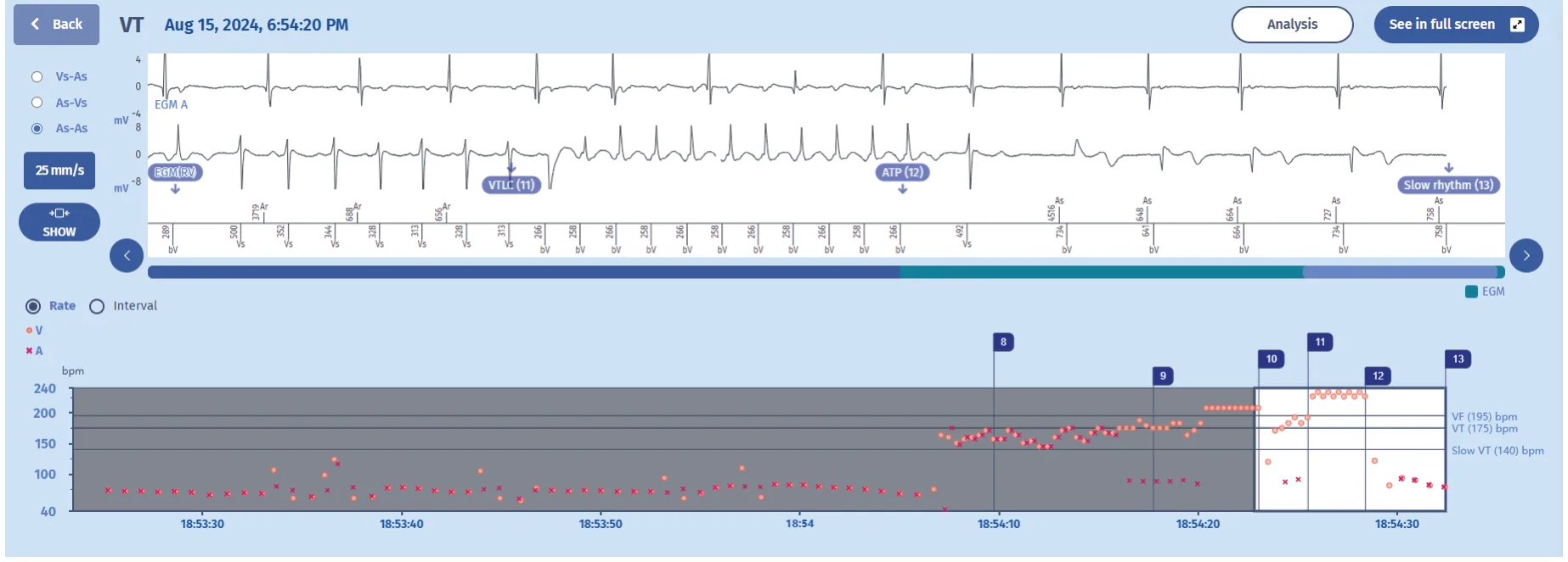 MicroPort ICD, Comments — 1:1 tachycardia