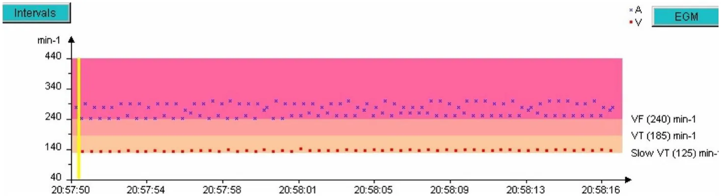 MicroPort ICD, Rate interval plot — Appropriate discrimination? Analyse everything!