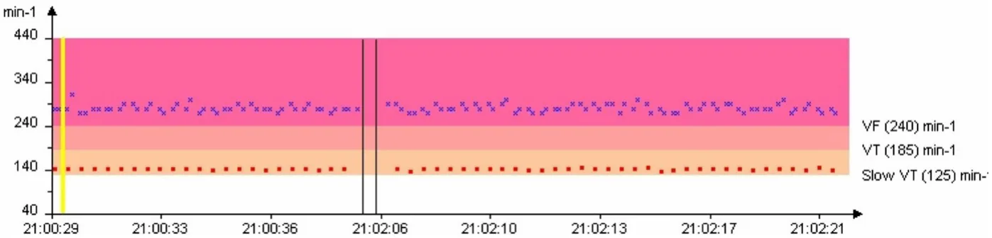 MicroPort ICD, Rate interval plot — Appropriate discrimination? Analyse everything!