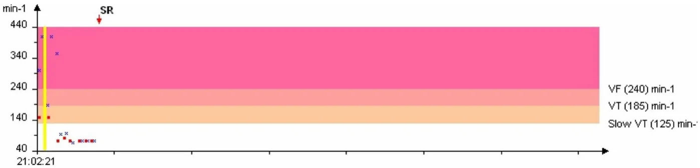 MicroPort ICD, Rate interval plot — Appropriate discrimination? Analyse everything!