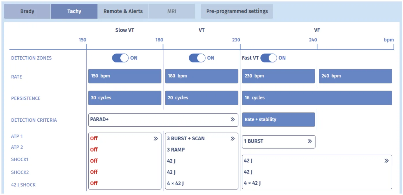 MicroPort ICD, Patient — T-wave oversensing