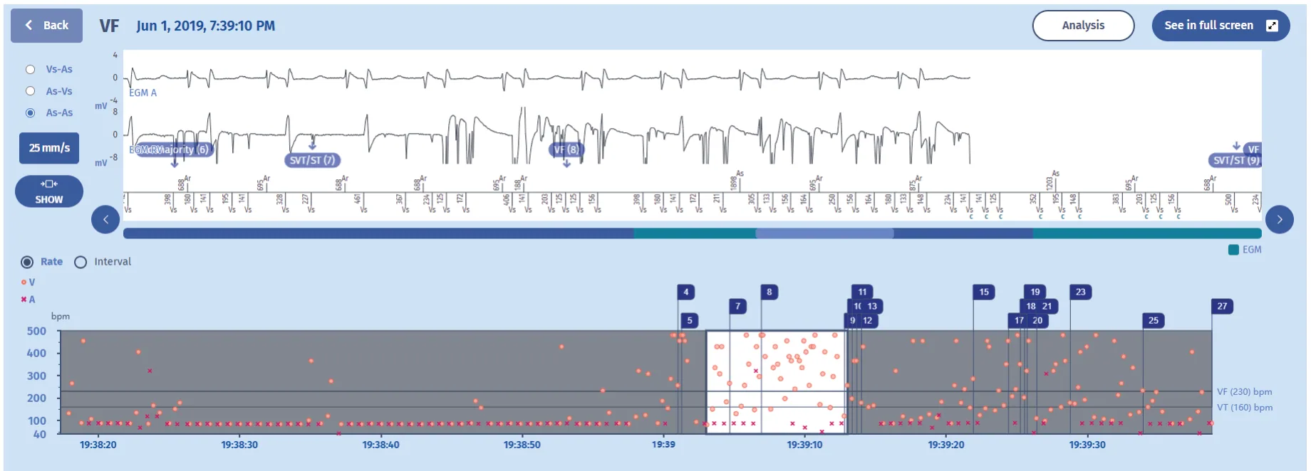 MicroPort ICD, What does this signify? — Lead dysfunction