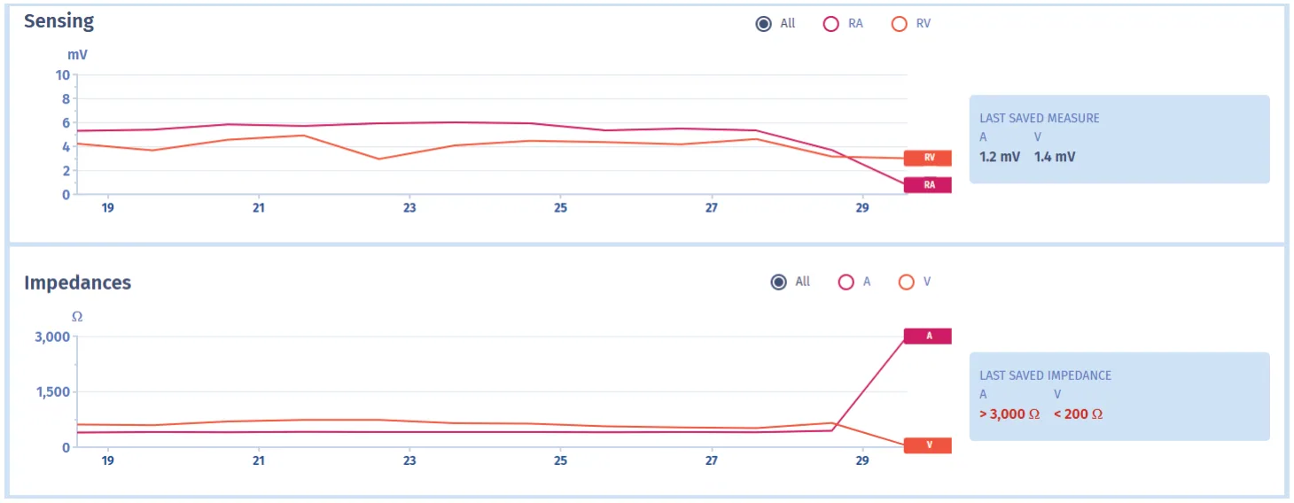 MicroPort ICD, Lead sensing and impedance trends — An emergency!