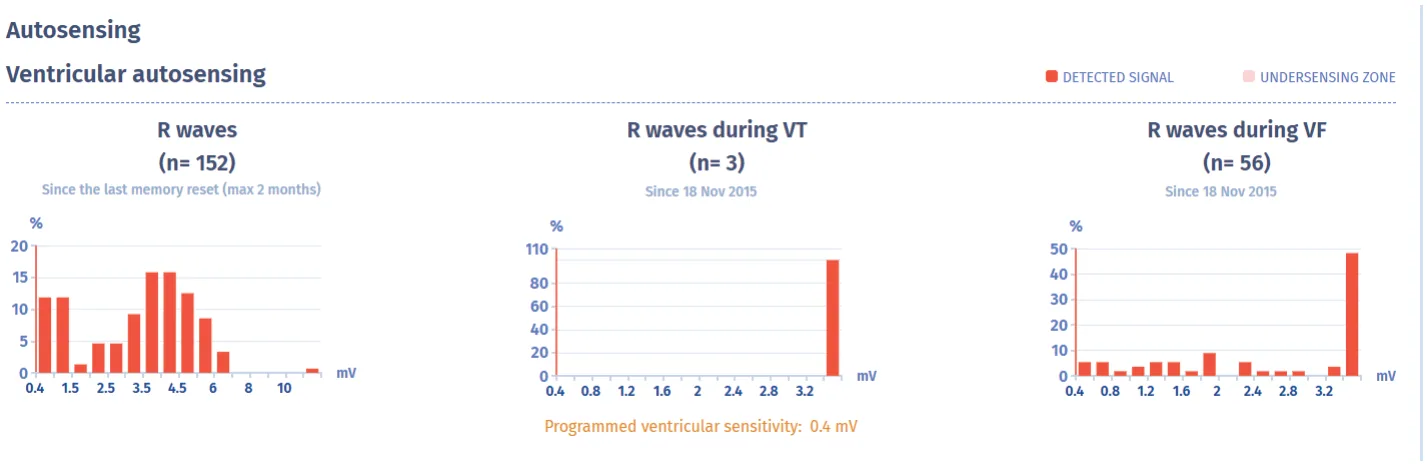 MicroPort ICD, Ventricular signal amplitudes — An emergency!