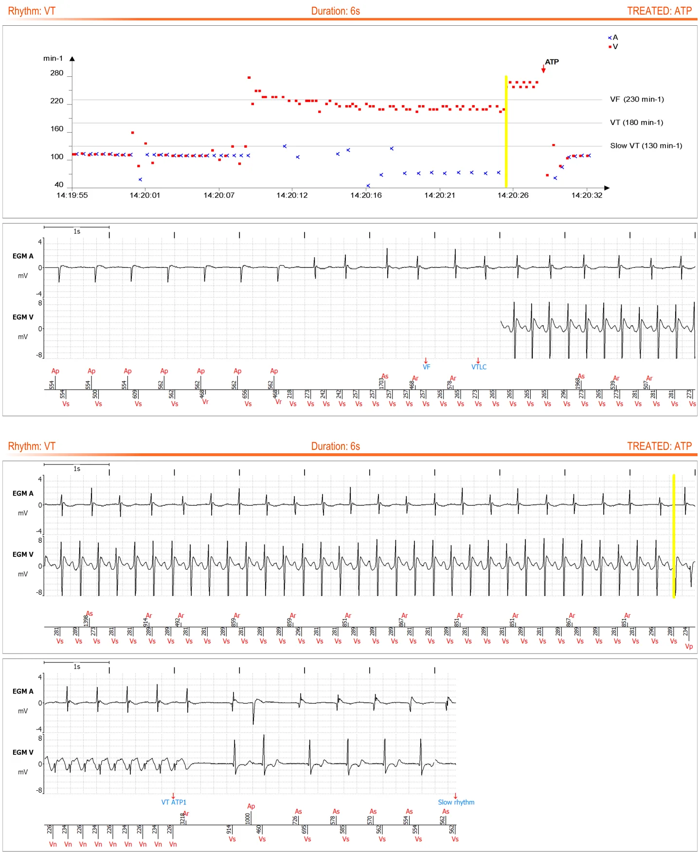 MicroPort ICD, You receive the following transmission: — ATP delivered