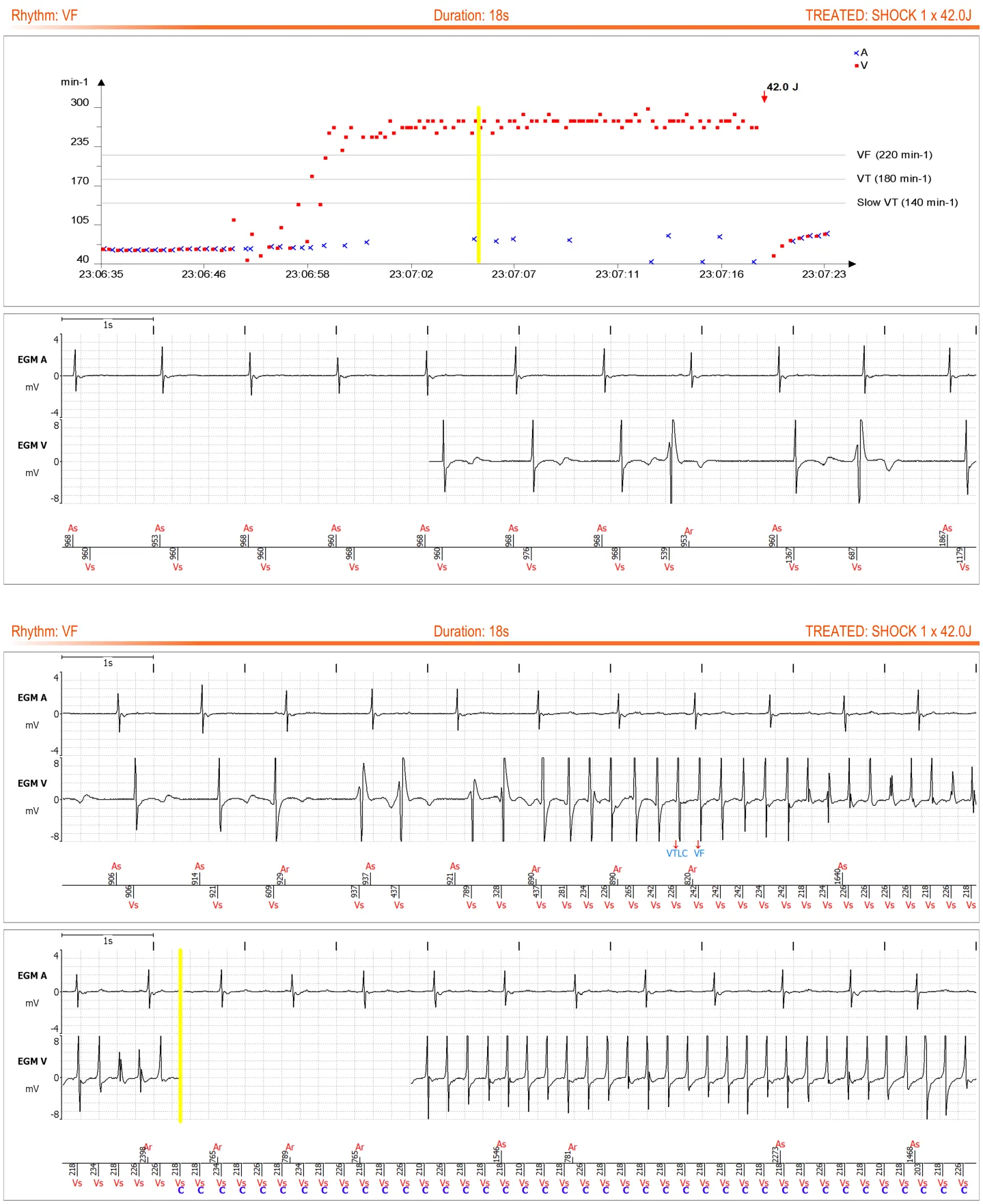 MicroPort ICD, Transmission 3 — Shocks delivered