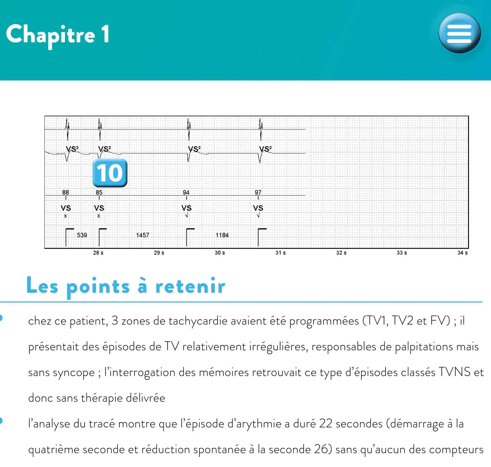 Compétition entre les différents compteurs de détection et réduction spontanée