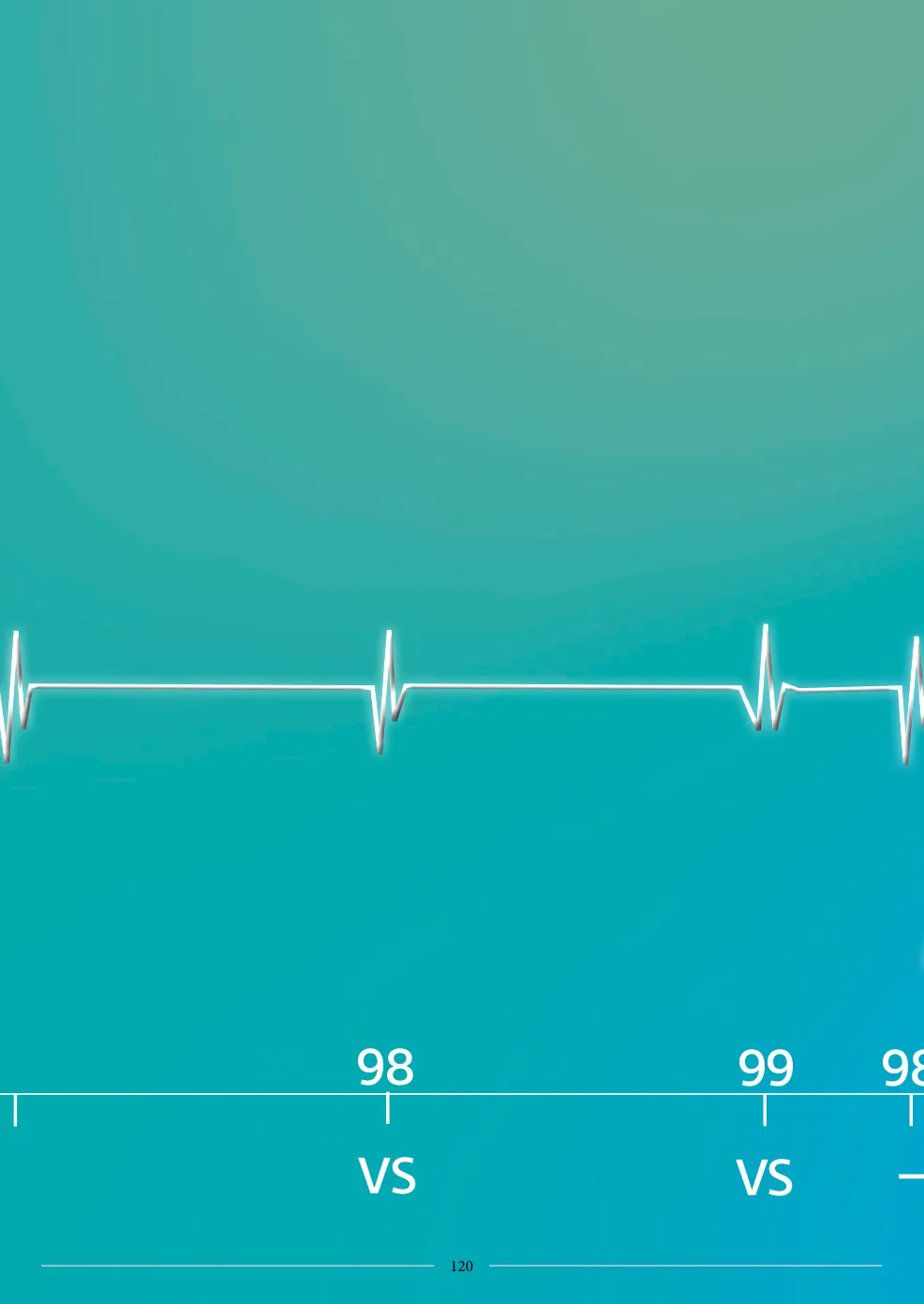 Accélération d’une TV par une stimulation anti-tachycardique et seuil de défibrillation élevé