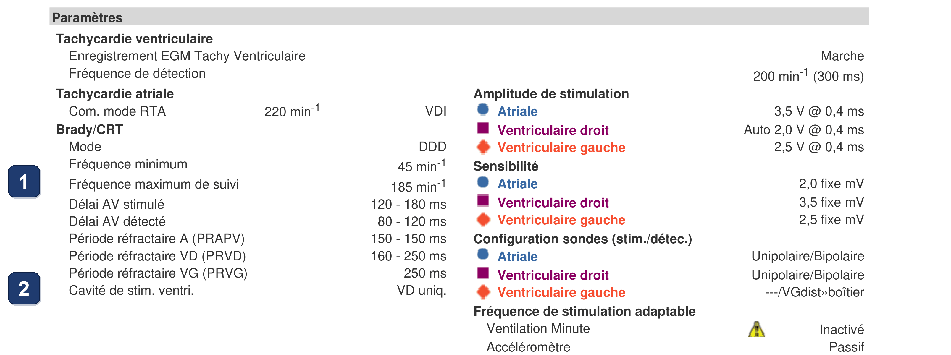 Électrogramme Boston Scientific CRT, segment 1/11 — Épisodes ventriculaires sur un CRT-P : qui les a déclenchés ?
