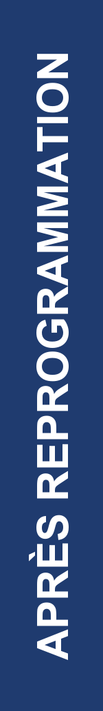 Électrogramme Boston Scientific CRT, segment 3/4 — Perte de resynchronisation au repos sur bradycardie sinusale