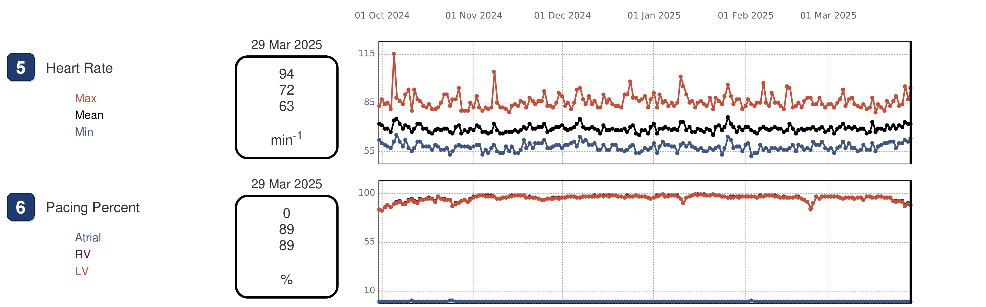 Électrogramme Boston Scientific CRT, segment 2/3 — CRT-D en rythme sinusal, stimulation BiV à 89 %