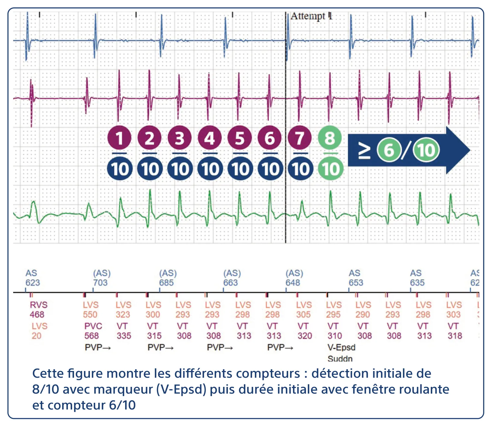 Cette figure montre les différents compteurs : détection initiale de 8/10 avec marqueur (V-Epsd) puis durée initiale avec fenêtre roulante et compteur 6/10
