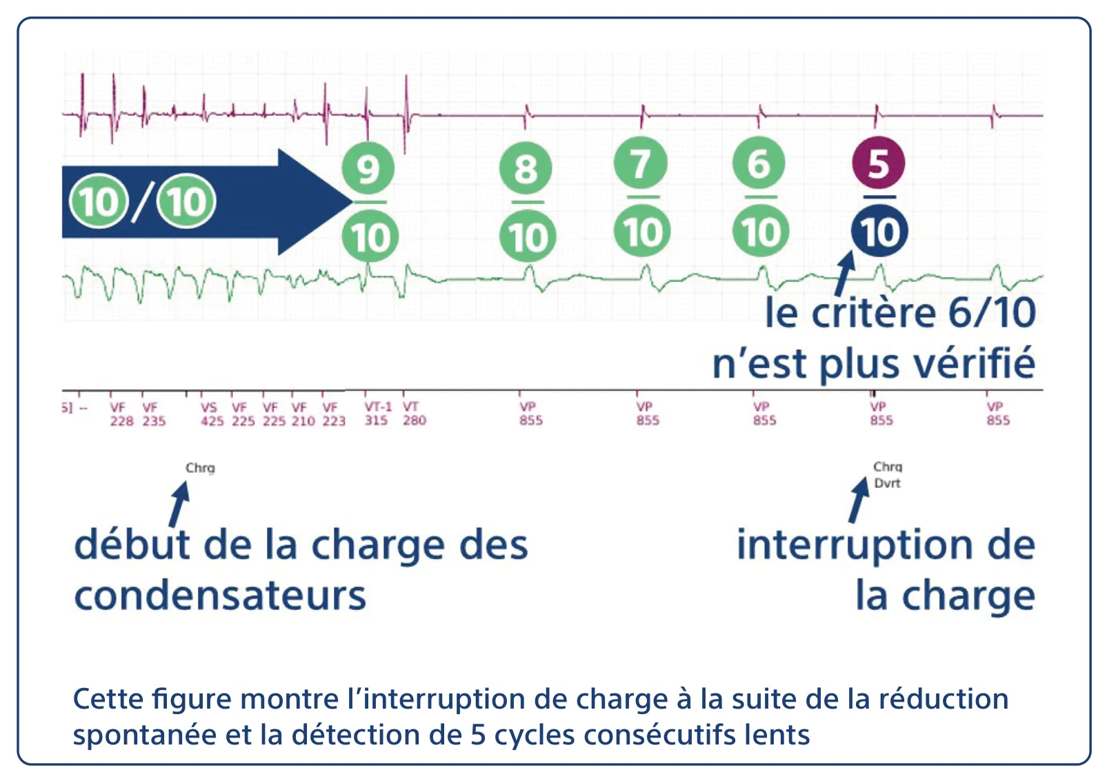 Cette figure montre l’interruption de charge à la suite de la réduction spontanée et la détection de 5 cycles consécutifs lents