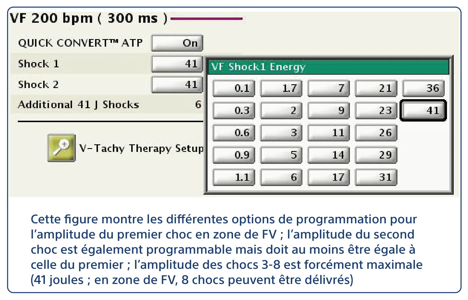 Cette figure montre les différentes options de programmation pour l’amplitude du premier choc en zone de FV ; l’amplitude du second choc est également programmable mais doit au moins être égale à celle du premier ; l’amplitude des chocs 3-8 est forcément maximale (41 joules ; en zone de FV, 8 chocs peuvent être délivrés)